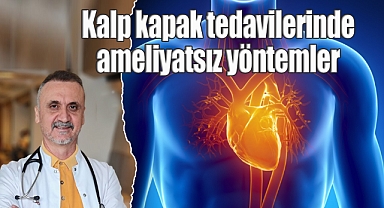 Kalp kapak tedavilerinde ameliyatsız yöntemler