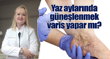 Yaz aylarında güneşlenmek varis yapar mı?