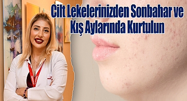 Cilt Lekelerinizden Sonbahar ve Kış Aylarında Kurtulun