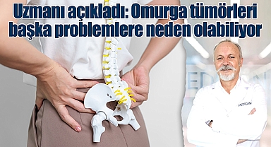 Uzmanı açıkladı: Omurga tümörleri başka problemlere neden olabiliyor