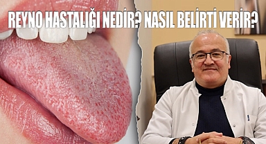 Reyno hastalığı nedir? Nasıl belirti verir?