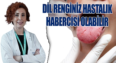 Dil renginiz hastalık habercisi olabilir!
