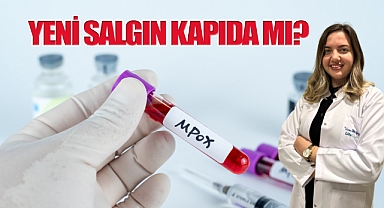 Maymun Çiçeği Virüsü Alarmı!