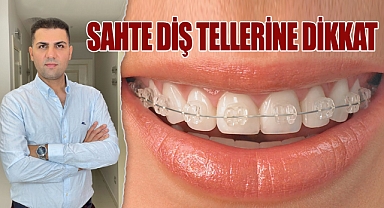 Sahte Diş Tellerine Dikkat!