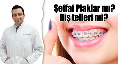 Şeffaf Plaklar mı? Diş telleri mi?
