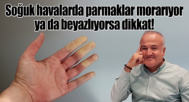 Soğuk havalarda parmaklar morarıyor ya da beyazlıyorsa dikkat!